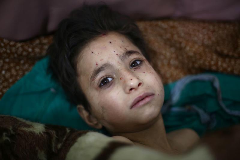 A child is seen in a hospital bed after being injured in a March 10 bombing near Damascus, Syria. "I urge all parties involved in the conflict to respect the cease-fire and strengthen talks underway -- the only path that leads to peace," Pope Francis said after reciting the "Regina Coeli" prayer with pilgrims gathered May 1 in the Vatican's St. Peter's Square. (CNS photo/Mohammed Badra, EPA)